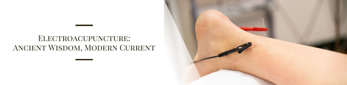 Electroacupuncture: Ancient Wisdom, Modern Current